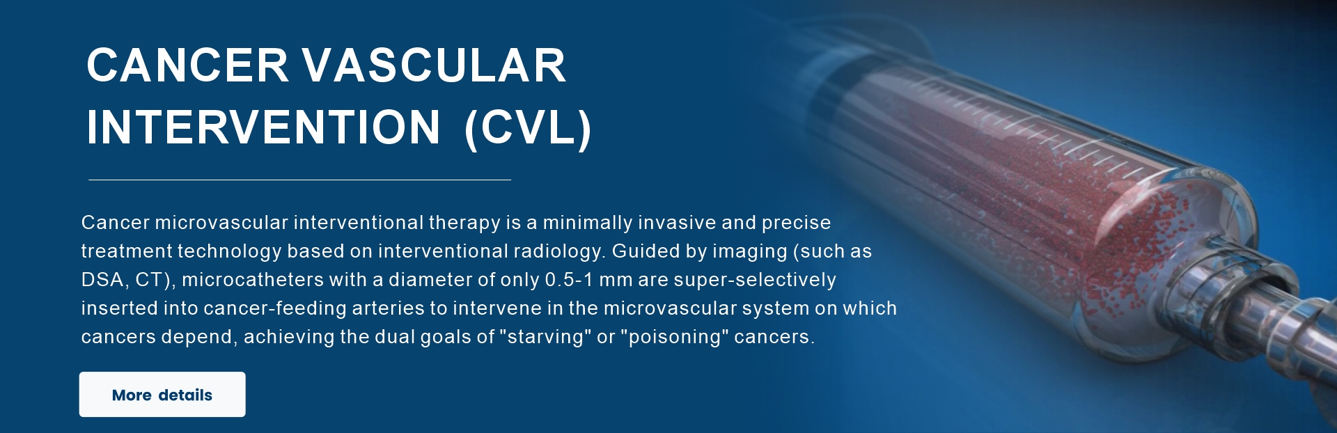 CANCER VASCULAR INTERVENTION (CVL)