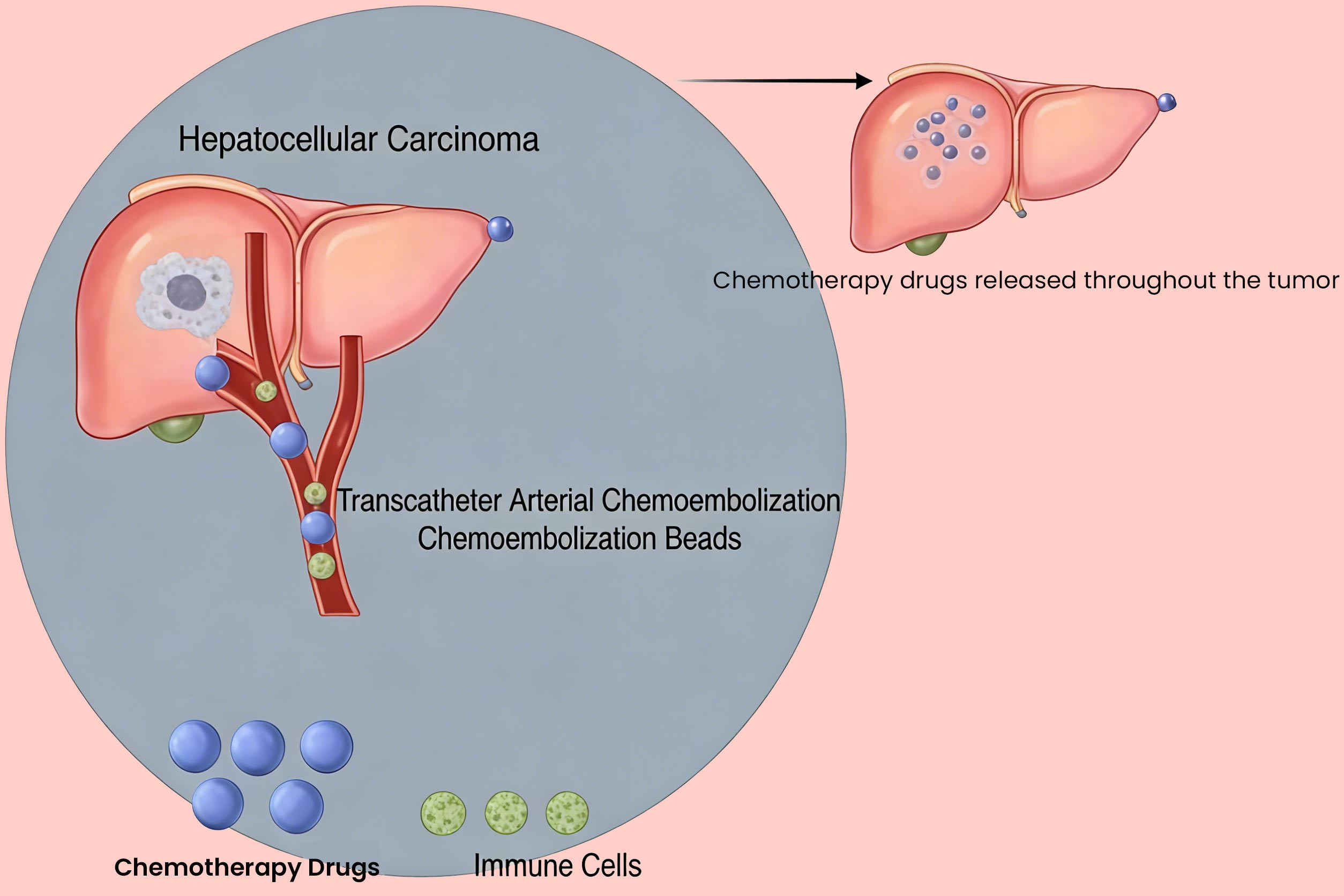 Innovative Treatment Techniques