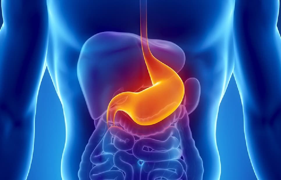 Gastric Cancer